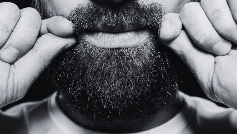 can having a beard cause acne?